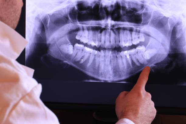 Best Emergency Treatment for Toothache in Old Jefferson, LA