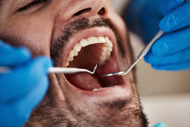 Best Emergency Broken Tooth Repair in Old Jefferson, LA