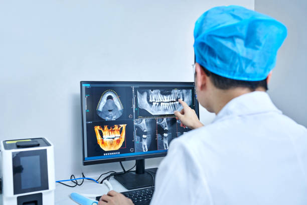 Best Emergency Wisdom Teeth Removal in Old Jefferson, LA